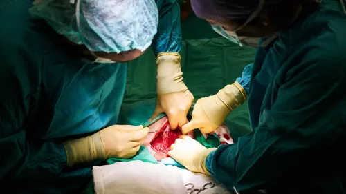 Un cœur de porc greffé sur un humain